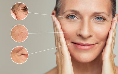 7 CAUSES OF FINE LINES AND WRINKLES